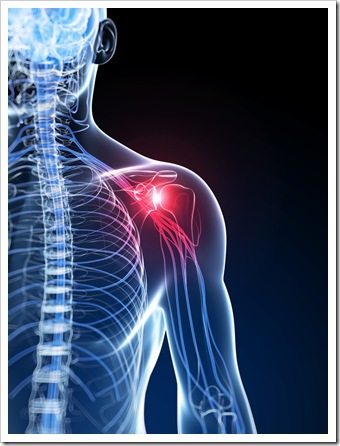 Shoulder Pain Warren OH Rotator Cuff Syndrome