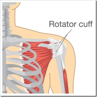 Shoulder Pain Warren OH Rotator Cuff Injury